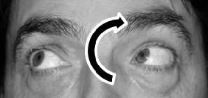 Augentraining: Einfache Übung, die Ihre Sehkraft verbessern kann SAVIR GmbH